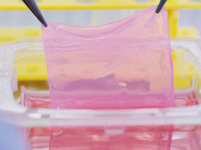 Nuova pelle per le vittime di ustioni