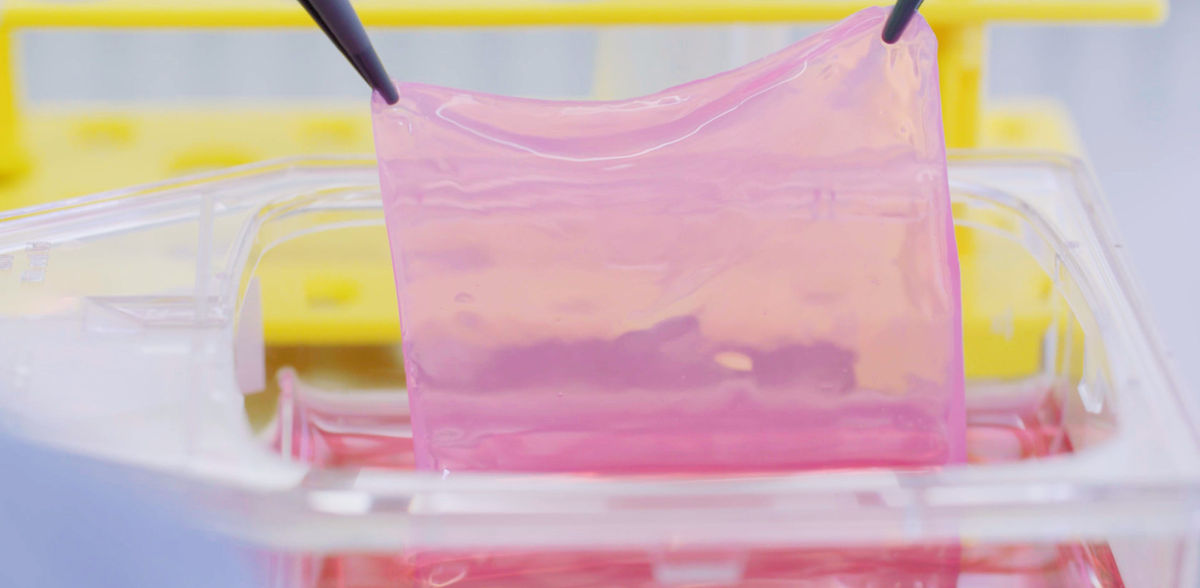 Copyright: Wyss Zurich