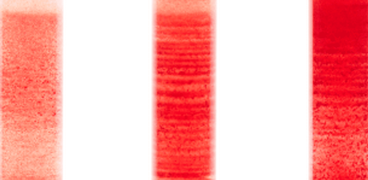 I ricercatori svelano il mistero della formazione delle bande nel sangue centrifugato