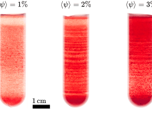Researchers crack the mystery of band pattern formation in centrifuged blood