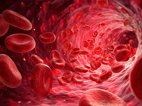 Neue Bildgebungstechnologie erkennt frühe Anzeichen von Herzkrankheiten durch die Haut