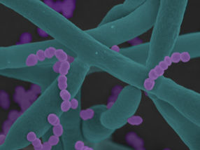 Two accomplices in the spotlight: When the interaction between fungi and bacteria becomes a dangerous alliance