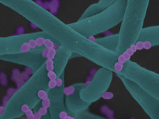 Deux complices sous les feux de la rampe : quand l'interaction entre champignons et bactéries devient une alliance dangereuse