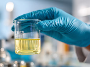 Children and adolescents contaminated with banned plasticizer