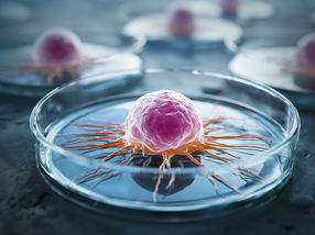 les microtumeurs en 3D pourraient révolutionner les décisions thérapeutiques