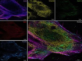 Mikrofluidik macht Superauflösungsmikroskopie reproduzierbar und benutzerfreundlich