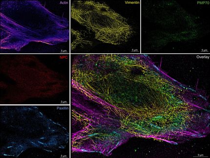 Microfluidics makes super-resolution microscopy reproducible and user-friendly