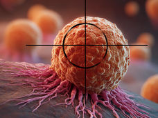 Novo ponto fraco descoberto no cancro da mama resistente à terapia