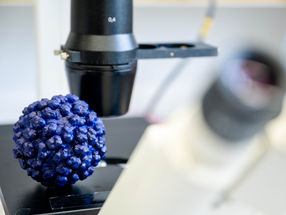 Vielversprechender Wirkstoff gegen Hepatitis E identifiziert