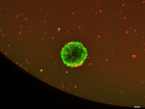 Already approved drug is effective against aggressive brain tumors