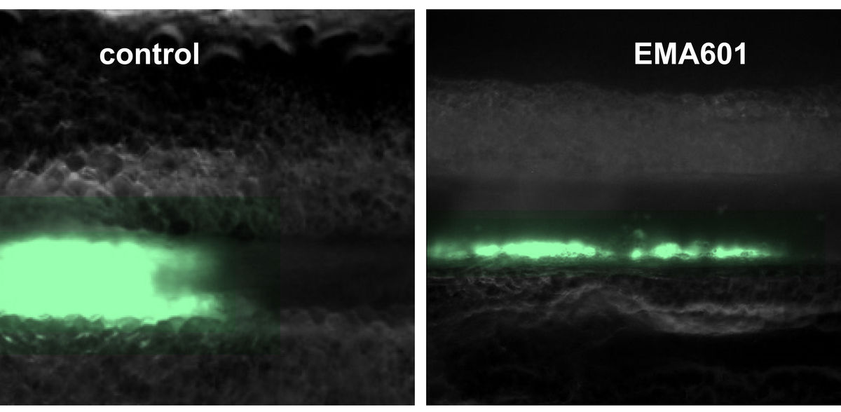 Un inhibiteur prometteur de GPVI franchit une étape importante vers le développement clinique
