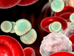New treatment approach against sepsis discovered