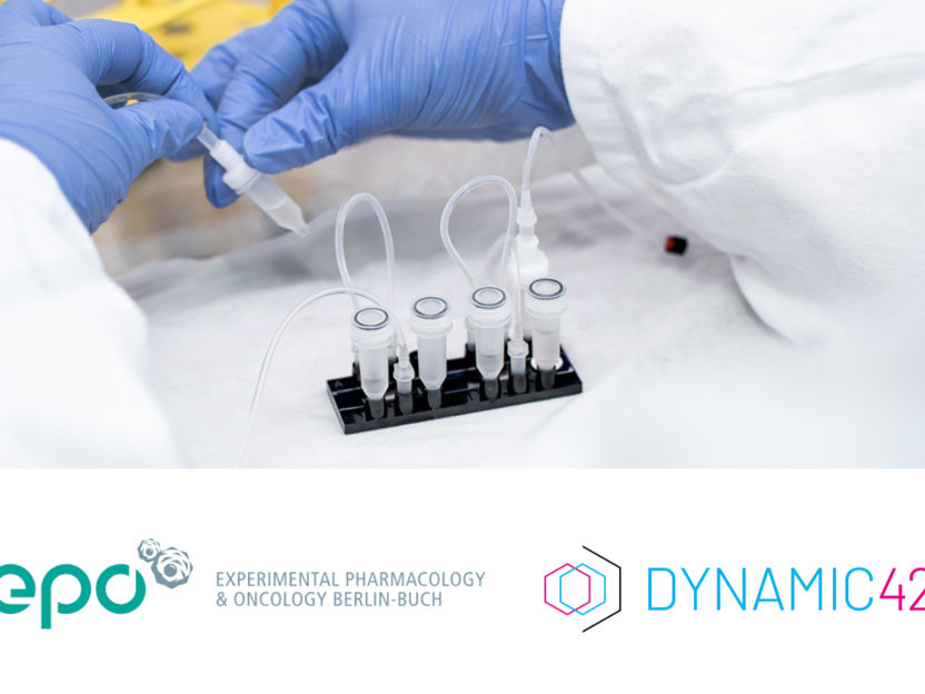 Dynamic42 et l'EPO comblent le fossé dans la recherche sur le cancer du cerveau - Une collaboration stratégique intègre la technologie des organes sur puce dans la recherche préclinique sur le glioblastome afin d'améliorer la pertinence translationnelle