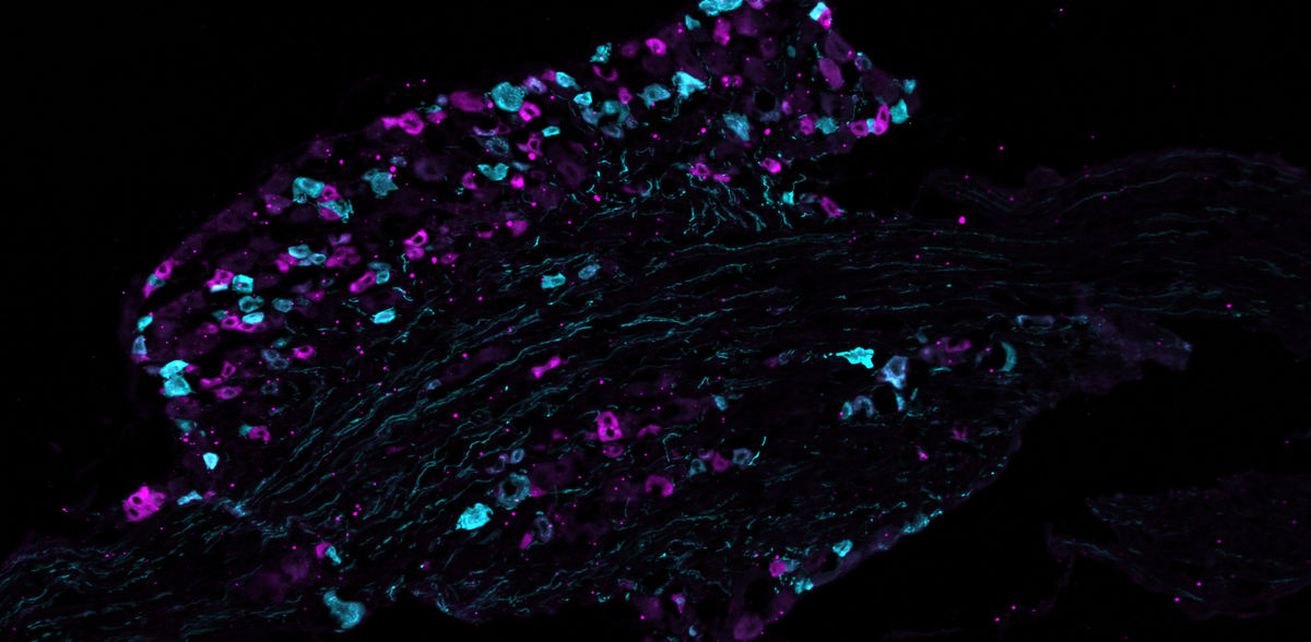  © Sampurna Chakrabarti, Max Delbrück Center
