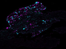 La première "carte protéique" des neurones à l'origine de la douleur révèle de nouvelles cibles pour les médicaments