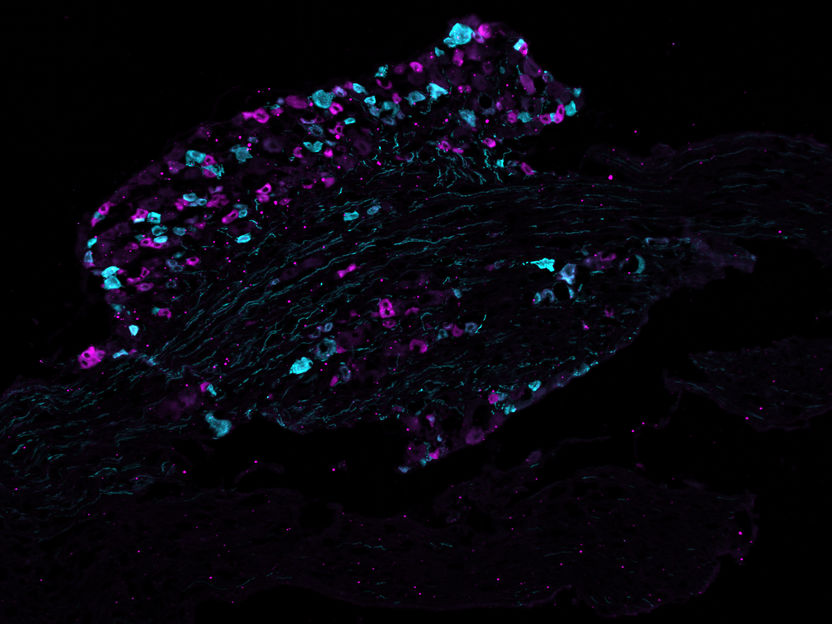 O primeiro "mapa proteico" dos neurónios que iniciam a dor revela novos alvos para os medicamentos - Proteómica visual profunda aplicada pela primeira vez às células nervosas