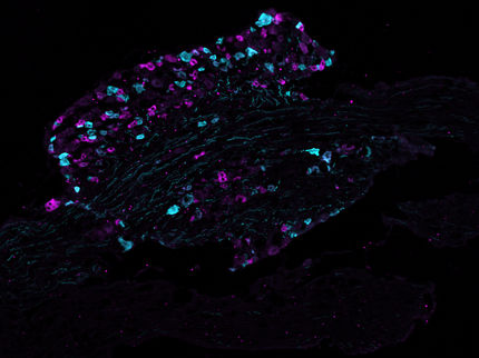 La première "carte protéique" des neurones à l'origine de la douleur révèle de nouvelles cibles pour les médicaments