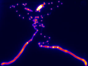 Logistics master in the cell: researchers decode the "navigation system" for mRNA