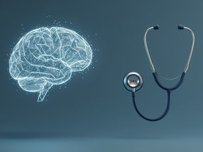 AI language models outperform medical specialists