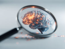 Brain tumor spread in the living brain observed live for the first time