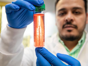 Cell factory for the immune system: New method makes macrophages scalable for research