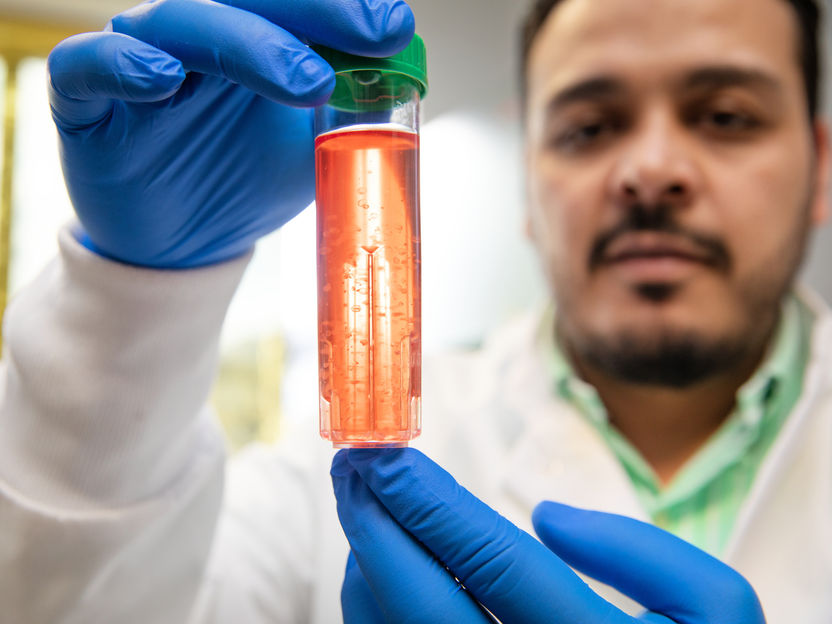 Cell factory for the immune system: New method makes macrophages scalable for research - Researchers are developing bioreactors to produce millions of human immune cells