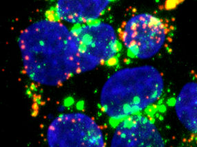 New cellular target prevents hepatitis E infection