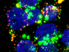 New cellular target prevents hepatitis E infection