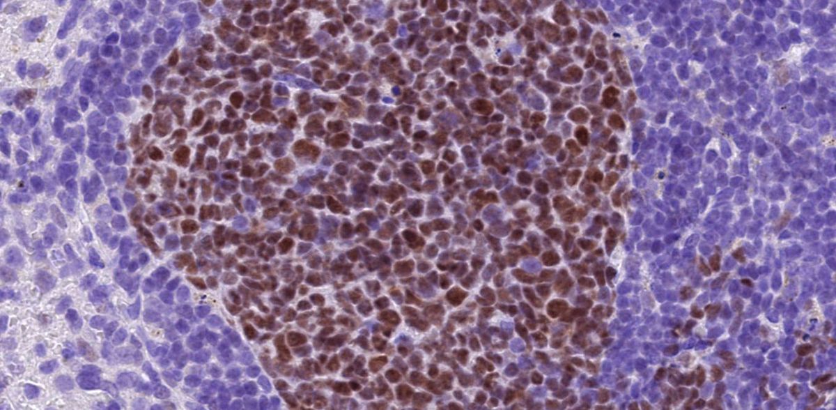 Copyright: Kristie Bariboloka / image visualised and analysed using QuPath