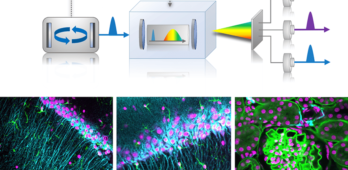 Innovative laser system advances microscopy method for revealing hidden cellular worlds