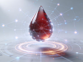 IMU Biosciences conclut une série A sursouscrite de 53 millions de dollars pour une plateforme de profilage immunitaire