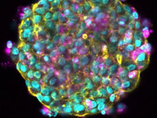 Forcing cancer cells to die whilst activating the immune system