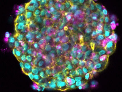 Forcing cancer cells to die whilst activating the immune system