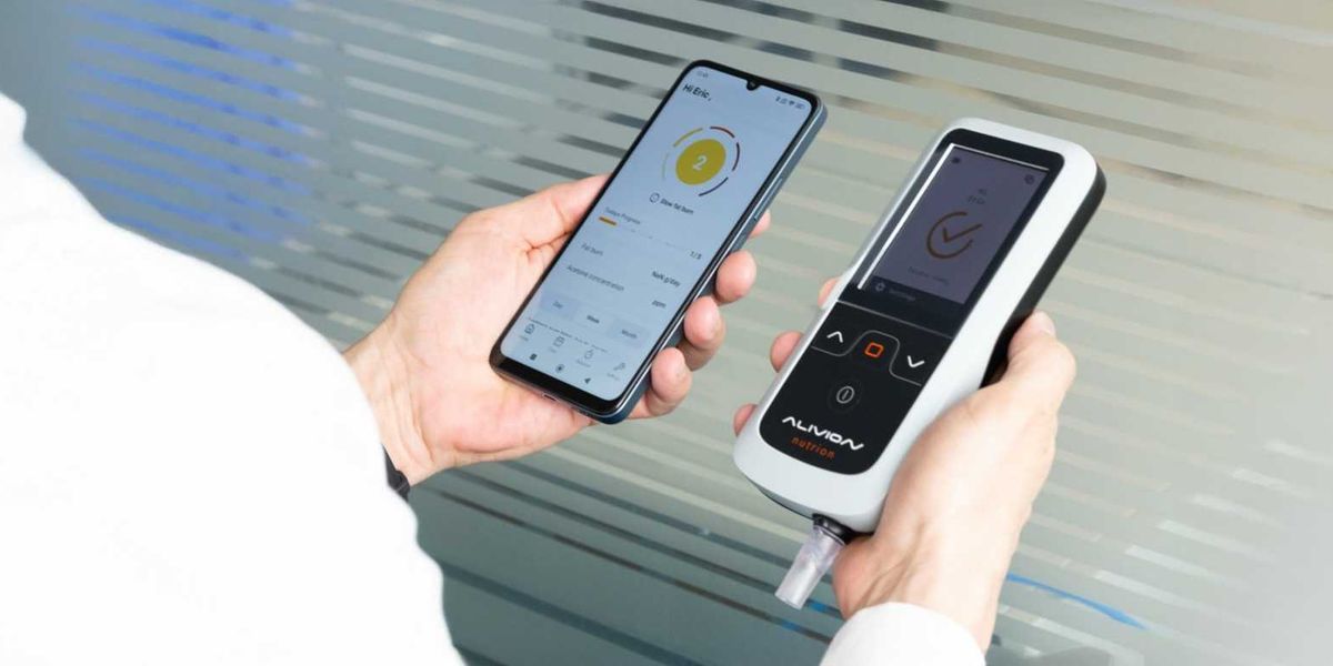 Alivion AG