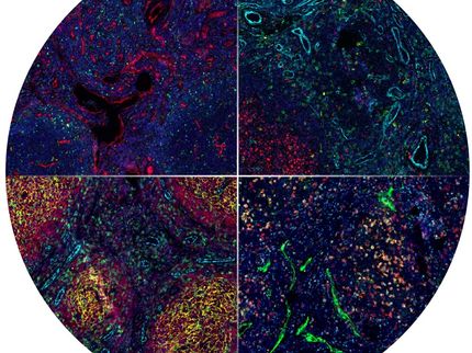 Advances in Cancer Research: New Software Simplifies the Analysis of Complex Tissue Images