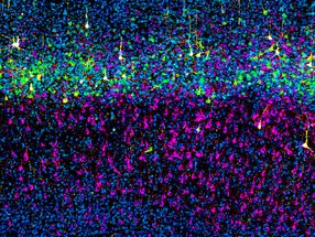 Neuronal Precursor Splits into Two Cell Lineages Earlier than Anticipated | Science Advances