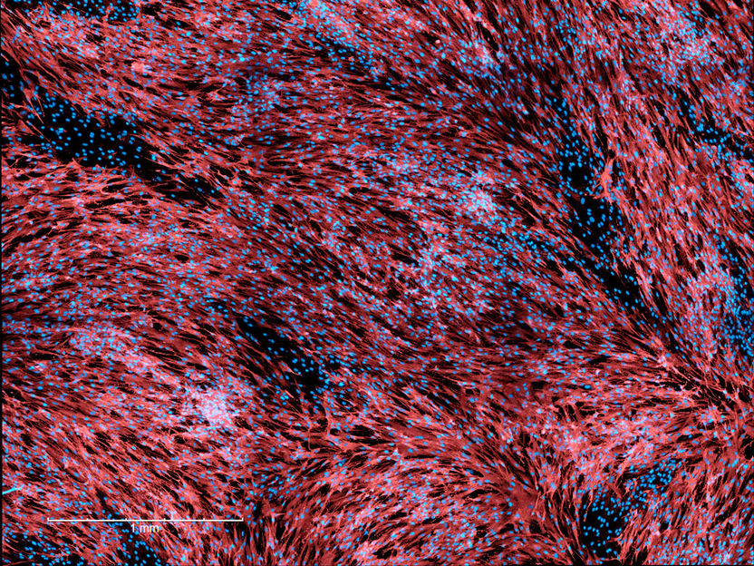 Sperma begünstigt Infektion durch MPox-Viren - Faserartige Proteine in Samenflüssigkeit erleichtern Virenaufnahme