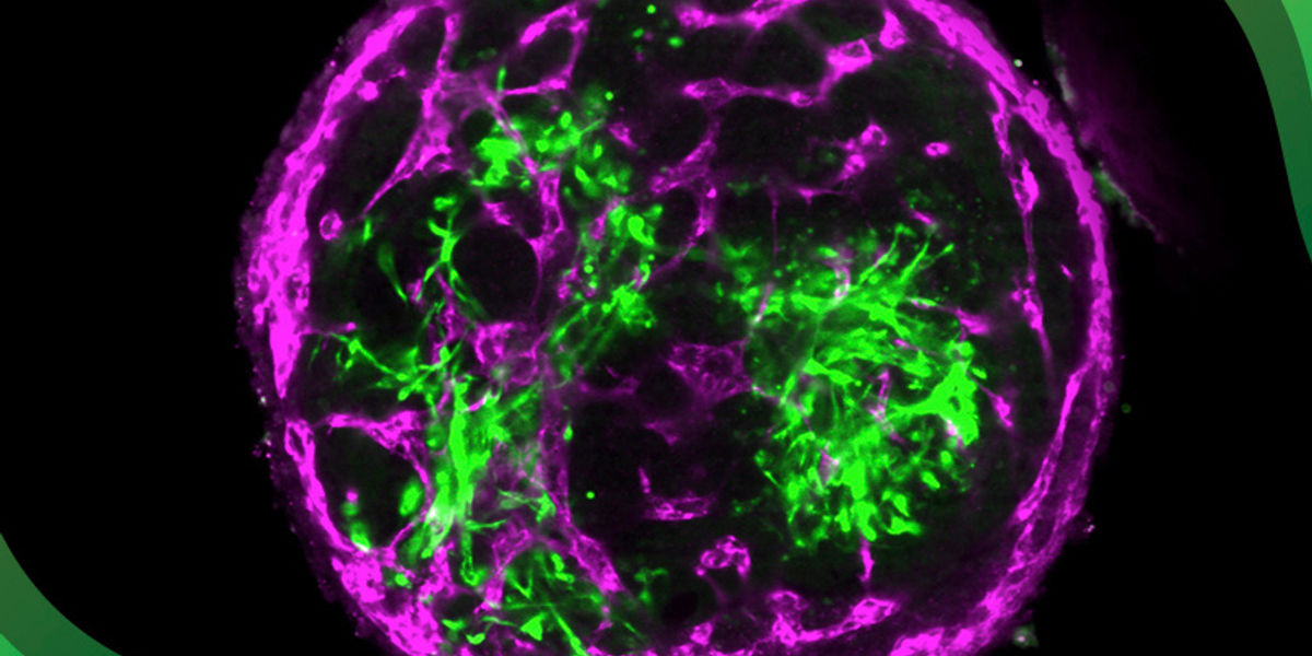 Le cellule staminali bovine offrono un nuovo approccio alla ricerca futura sulla carne di manzo coltivata in laboratorio
