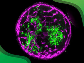 Bovine stem cells offer new approach to future cultivated steak research