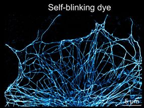 Faster, sharper, easier imaging with “self-blinking dyes”
