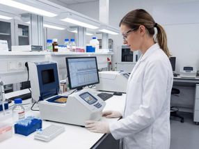 Diatech Pharmacogenetics übernimmt SensoQuest