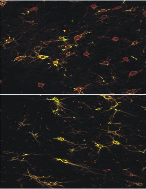 Schneller lernen durch magnetische Hirnstimulation