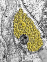 Neues Angriffsziel für Hepatitis C-Therapie entdeckt