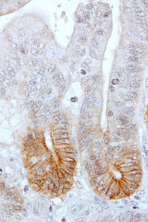 Epitelio de intestino