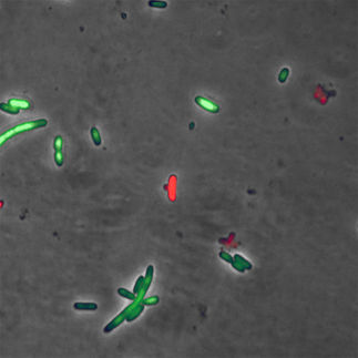 Escherichia coli Zellen