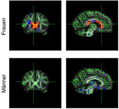 Effects of obesity on the brain: first evidence of sex-related differences in the brain’s white matter structure