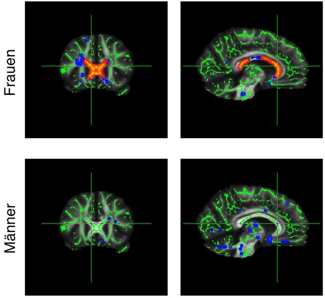 © Max Planck Institute for Human Cognitive and Brain Sciences