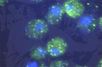 yeast cells expressing human FUS/TLS