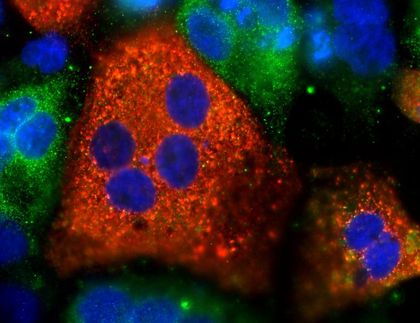 Hepatitis C am Scheideweg