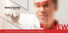 La solución «todo en uno» de CANDOR para análisis Western Blot